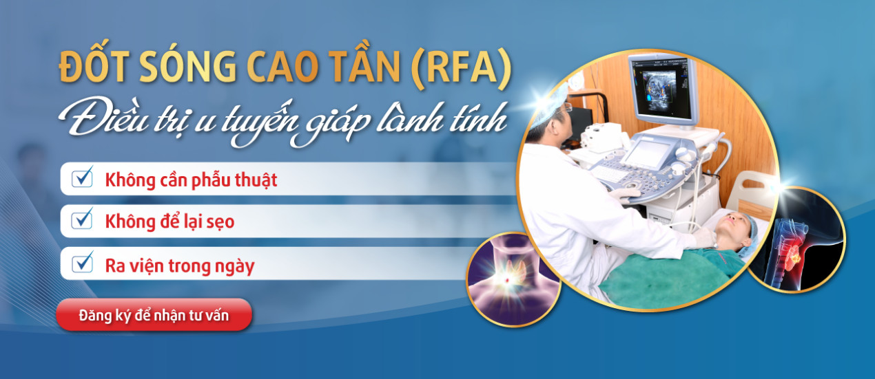 Đốt sóng cao tần (RFA) điều trị u tuyến giáp lành tính với chi phí hợp lý - ảnh 1