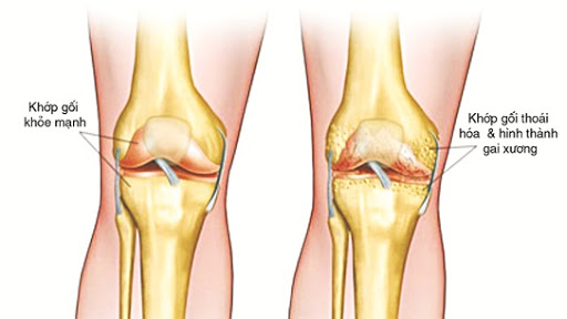 10 Địa điểm đáng tin cậy để khám và điều trị thoái hóa khớp gối tại Hà Nội - ảnh 4