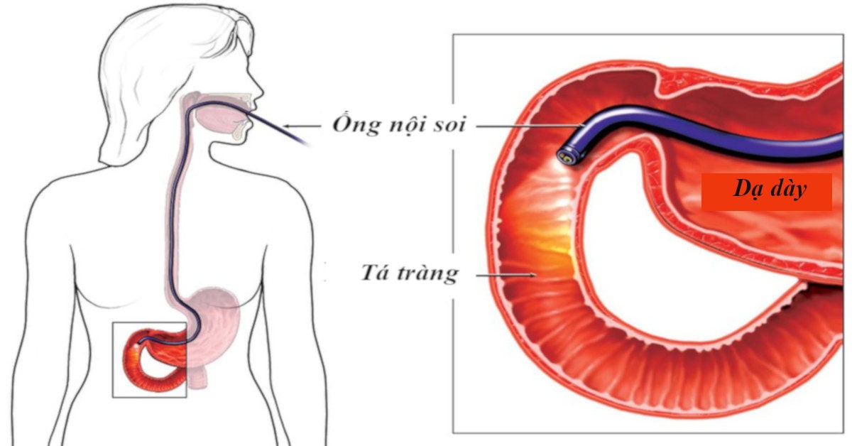 4 Bác Sĩ Nội Soi Tiêu Hóa Hàng Đầu Tại Hà Nội - ảnh 1