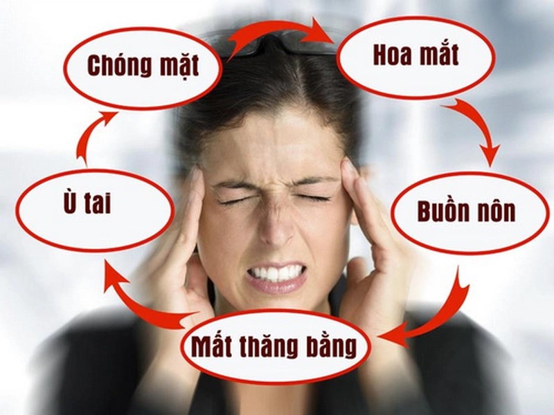 Rối Loạn Tiền Đình Ngoại Biên Có Nguy Hiểm Không? Dấu Hiệu, Biến Chứng Và Cách Điều Trị - ảnh 1