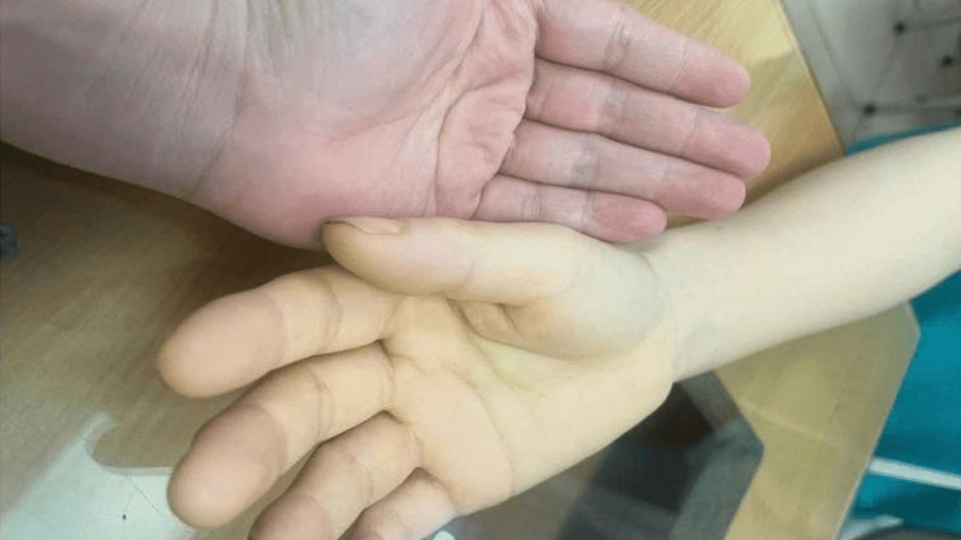 Chủ quan với u xơ tử cung, bệnh nhân 43 tuổi thiếu máu nặng đe dọa tính mạng - ảnh 1