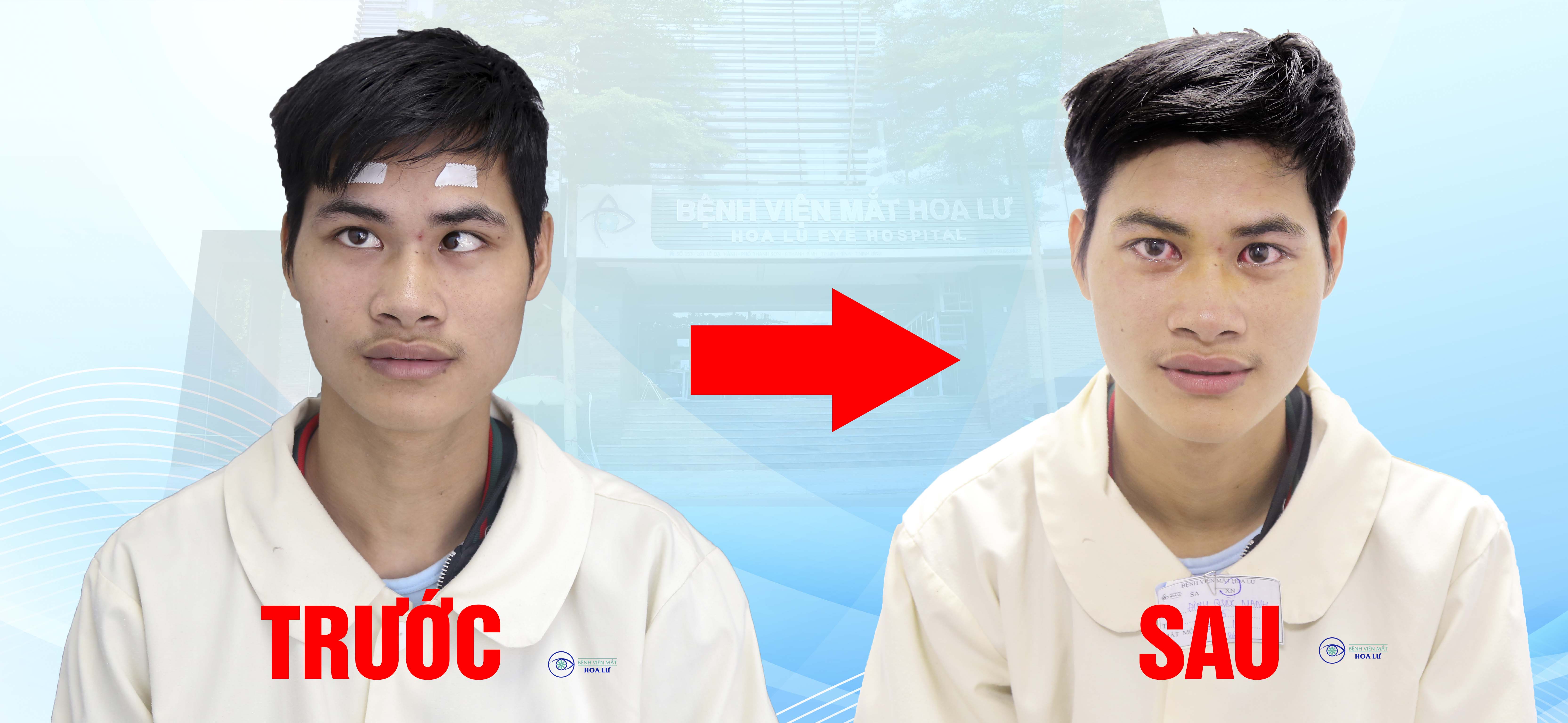 TỪ MẶC CẢM “MẮT LÁC” ĐẾN GIẤC MƠ KHOÁC ÁO LÍNH: HÀNH TRÌNH CỦA TÂN BINH ĐINH QUỐC MẠNH - ảnh 1