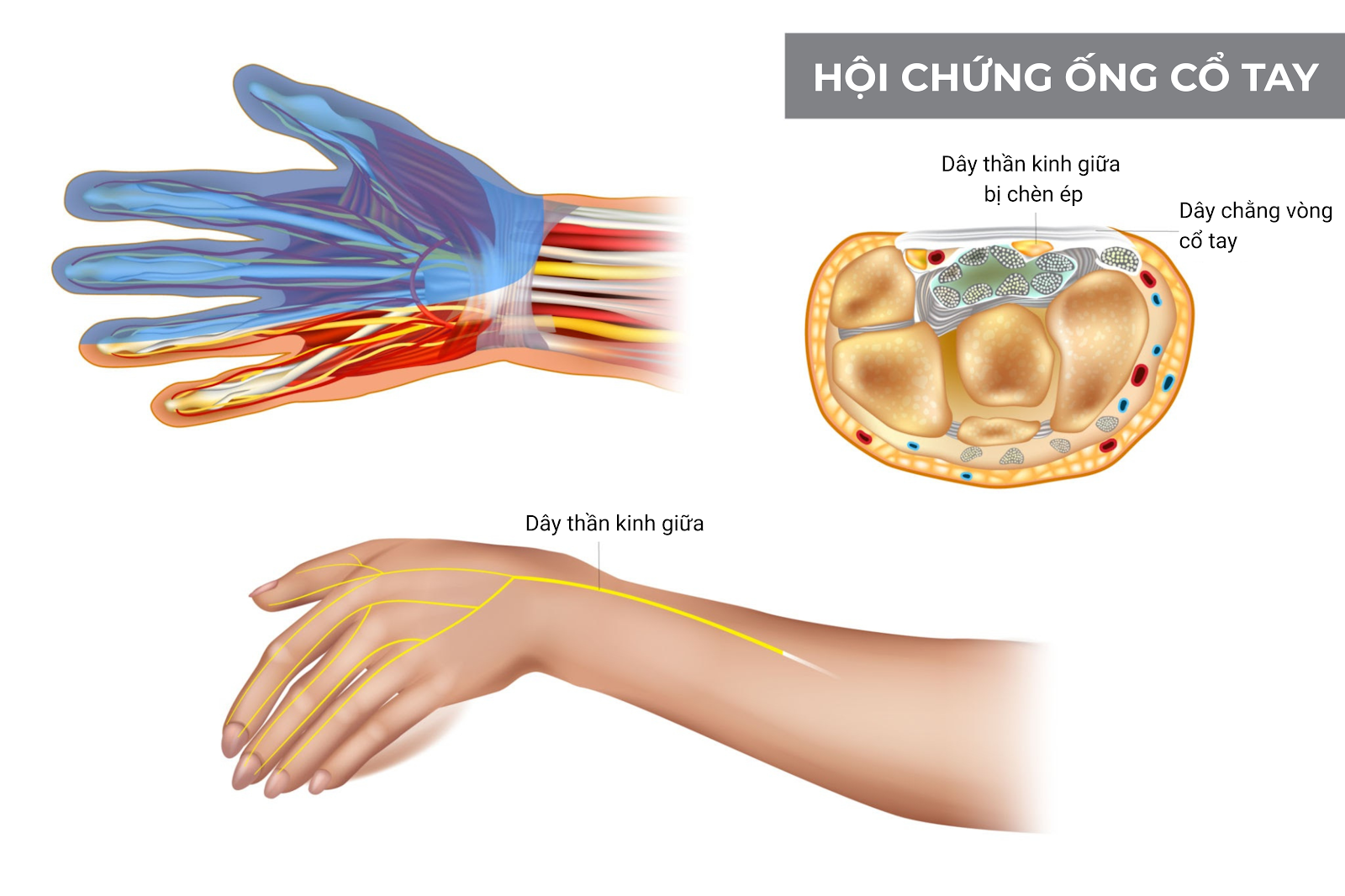 5 bác sĩ khám và điều trị Hội chứng ống cổ tay giỏi tại Hà Nội - ảnh 1