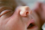 Một số bệnh về mắt thường gặp ở trẻ sơ sinh