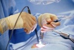 Phẫu thuật tim hở ít xâm lấn có nội soi hỗ trợ thay van 2 lá