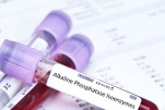 Ý nghĩa của xét nghiệm phosphatase kiềm (ALP) trong chẩn đoán bệnh gan xương