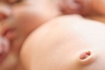 Thoát vị rốn ở trẻ sơ sinh: Nguyên nhân, dấu hiệu, biến chứng và điều trị