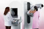 Vai trò của X-quang vú trong chẩn đoán bệnh lý vú và ung thư vú