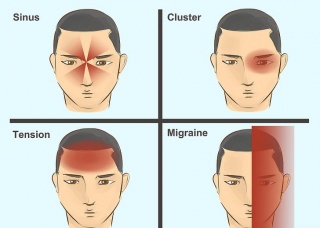 Ảnh 2 của Migraine