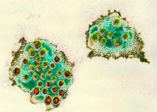 Ảnh 1 của Nhiễm Norovirus