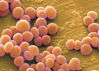Ảnh 1 của Nhiễm khuẩn tụ cầu vàng kháng Methicillin (MRSA)