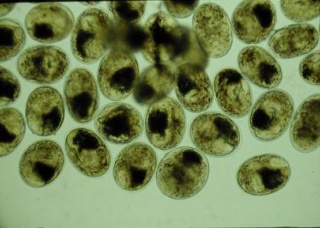 Ảnh 4 của Nhiễm sán dây chó (Echinococcus)