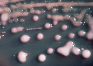 Ảnh 4 của Nhiễm khuẩn Klebsiella