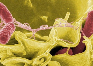 Ảnh 3 của Nhiễm khuẩn Salmonella