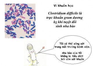 Ảnh 1 của Nhiễm vi khuẩn Clostridium difficile (C. Diff)