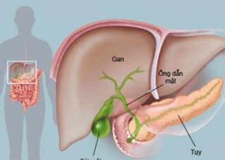 Ảnh 1 của Pancreatic cyst