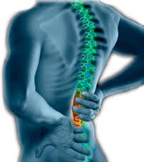 Ảnh 3 của Chấn thương lưng