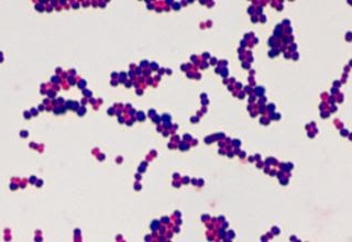 Ảnh 3 của Streptococcus