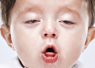 Ảnh 1 của Whooping cough
