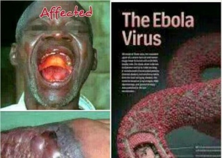 Ảnh 1 của Ebola