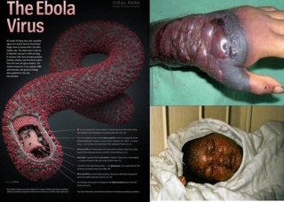 Ảnh 3 của Ebola
