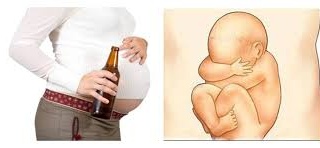 Ảnh 2 của Fetal Alcohol Syndrome