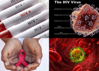 Ảnh 4 của HIV/AIDS
