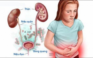 Nhiễm khuẩn tiết niệu ở trẻ em: Nguyên nhân, dấu hiệu, điều trị