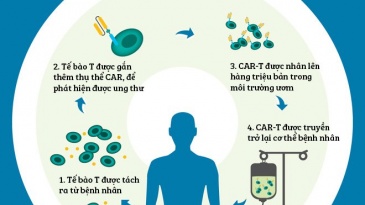 Liệu pháp tế bào CAR-T trong điều trị ung thư