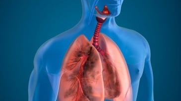 Những xét nghiệm giúp phát hiện bệnh phổi tắc nghẽn mãn tính