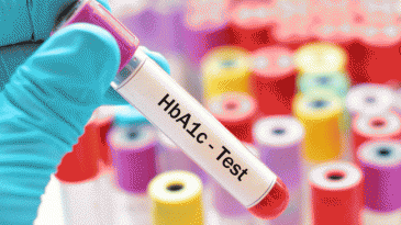 Ý nghĩa xét nghiệm HbA1c trong kiểm soát glucose ở bệnh nhân đái tháo đường
