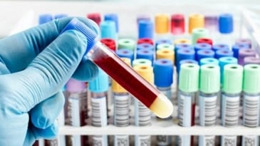 Xét nghiệm máu có phát hiện bệnh ung thư hay không?