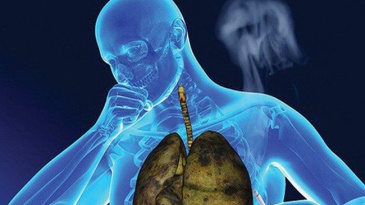 Điều trị ung thư phổi bằng phương pháp xạ trị