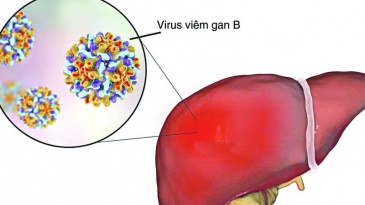 Triệu chứng và cách phòng ngừa viêm gan B cấp tính