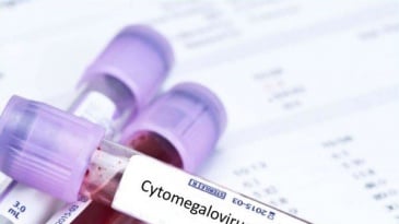 Xét nghiệm CMV Chẩn đoán nhiễm virus cytomegalo