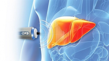 FibroScan đo độ đàn hồi và độ nhiễm mỡ của gan được sử dụng để đánh giá mức độ Xơ gan