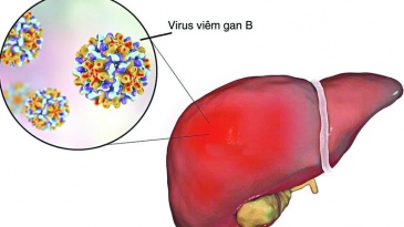 Điều trị bệnh viêm gan B theo từng trường hợp cụ thể