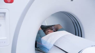 Chụp cộng hưởng từ khuếch tán (DWI-Diffusion-weighted Imaging)