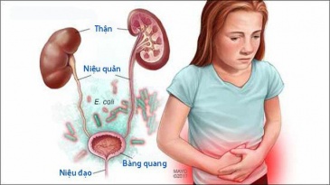 Nhiễm khuẩn tiết niệu ở trẻ em: Nguyên nhân, dấu hiệu, điều trị