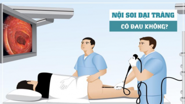 Nội soi trực tràng hậu môn có đau không?