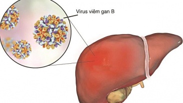 Những điều cần biết khi sử dụng thuốc kháng virus viêm gan B