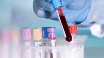 Xét nghiệm NAT phát hiện Viêm gan B – Viêm gan C sớm và chính xác