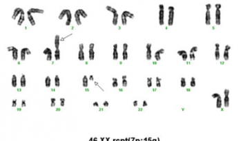 Karyotype Test là gì? Ứng dụng trong điều trị hiếm muộn