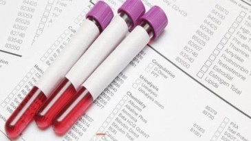 Anti HBe là gì? Chỉ số Anti HBe có ý nghĩa gì trong xét nghiệm viêm gan B?