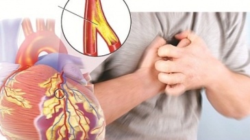 Quy trình chụp cộng hưởng từ động mạch vành