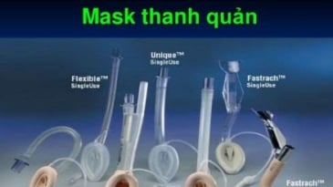 Những điều cần biết về Gây mê mask thanh quản phẫu thuật áp xe dưới màng tủy