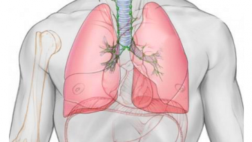 Căng phồng phổi quá mức - nhận biết và điều trị