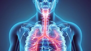 Những yếu tố nguy cơ gây của bệnh ung thư phổi