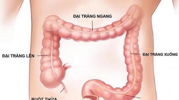 Quy trình chụp cộng hưởng từ nội soi ảo khung đại tràng