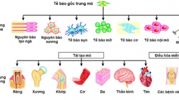 Ứng dụng lâm sàng của Tế bào gốc trung mô dây rốn trong điều trị phổi tắc nghẽn mạn t